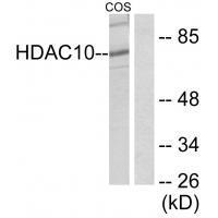 HDAC1