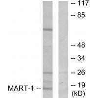 MART-1