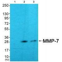 Rabbit Polyclonal Antibody to MMP-7