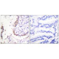Rabbit Polyclonal Antibody to 45202