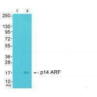 p14 ARF