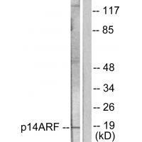 Rabbit Polyclonal Antibody to p14 ARF