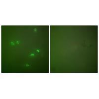 Rabbit Polyclonal Antibody to p14 ARF
