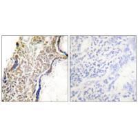 Rabbit Polyclonal Antibody to p14 ARF