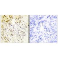 Rabbit Polyclonal Antibody to Cyclin-L1
