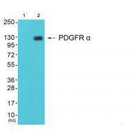 Rabbit Polyclonal Antibody to PDGFR α