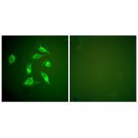 Rabbit Polyclonal Antibody to PDGFR α