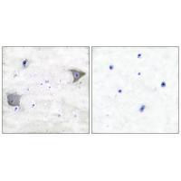 Rabbit Polyclonal Antibody to PDGFR α