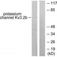 Potassium Channel Kv3.2b