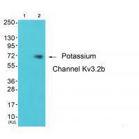 Rabbit Polyclonal Antibody to Potassium Channel Kv3.2b
