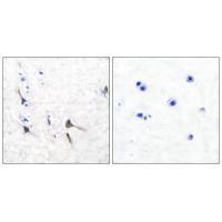 Rabbit Polyclonal Antibody to Potassium Channel Kv3.2b