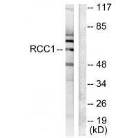 RCC1