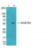 Rabbit Polyclonal Antibody to RCC1