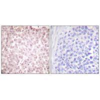Rabbit Polyclonal Antibody to RCC1
