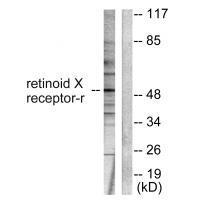 Retinoid X Receptor γ