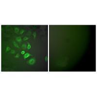 Rabbit Polyclonal Antibody to S10A1