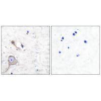Rabbit Polyclonal Antibody to S10A1