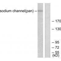 Sodium Channel-pan