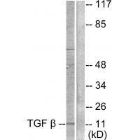 TGF β3