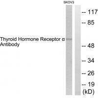 Thyroid Hormone Receptor α