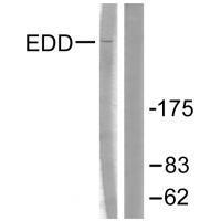 EDD