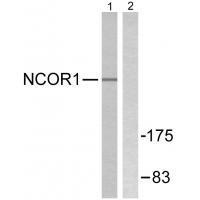NCoR1