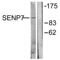 SENP7