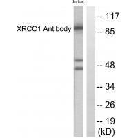 XRCC1