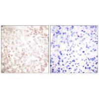 Rabbit Polyclonal Antibody to XRCC1