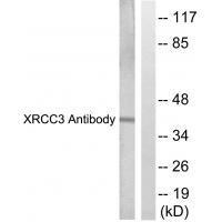 XRCC3