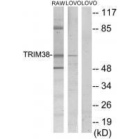 TRIM38