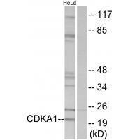 CDKA1