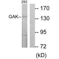 GAK