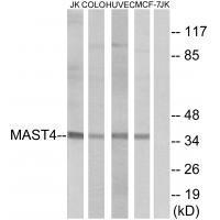 MAST4