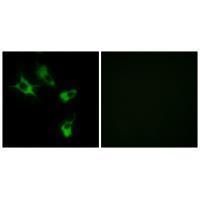 Rabbit Polyclonal Antibody to MAST4