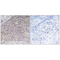 Rabbit Polyclonal Antibody to MAST4