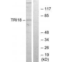 TRI18