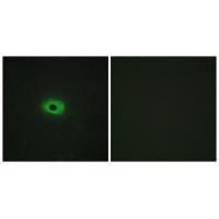 Rabbit Polyclonal Antibody to TNF12