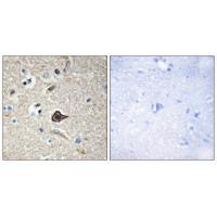 Rabbit Polyclonal Antibody to TNF12