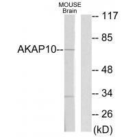 AKAP1