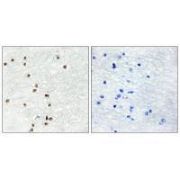 Rabbit Polyclonal Antibody to ZIC1/2/3