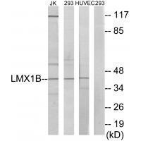 LMX1B