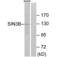 SIN3B