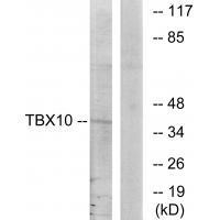 TBX1