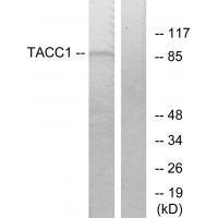 TACC1