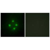 Rabbit Polyclonal Antibody to MED24