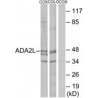 ADA2L