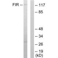 FIR