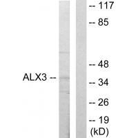 ALX3