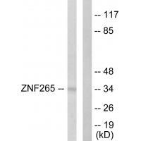 ZNF265